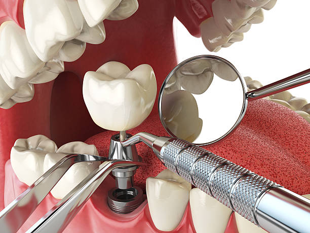 Best Weekend Emergency Dentist in Buena Vista, GA